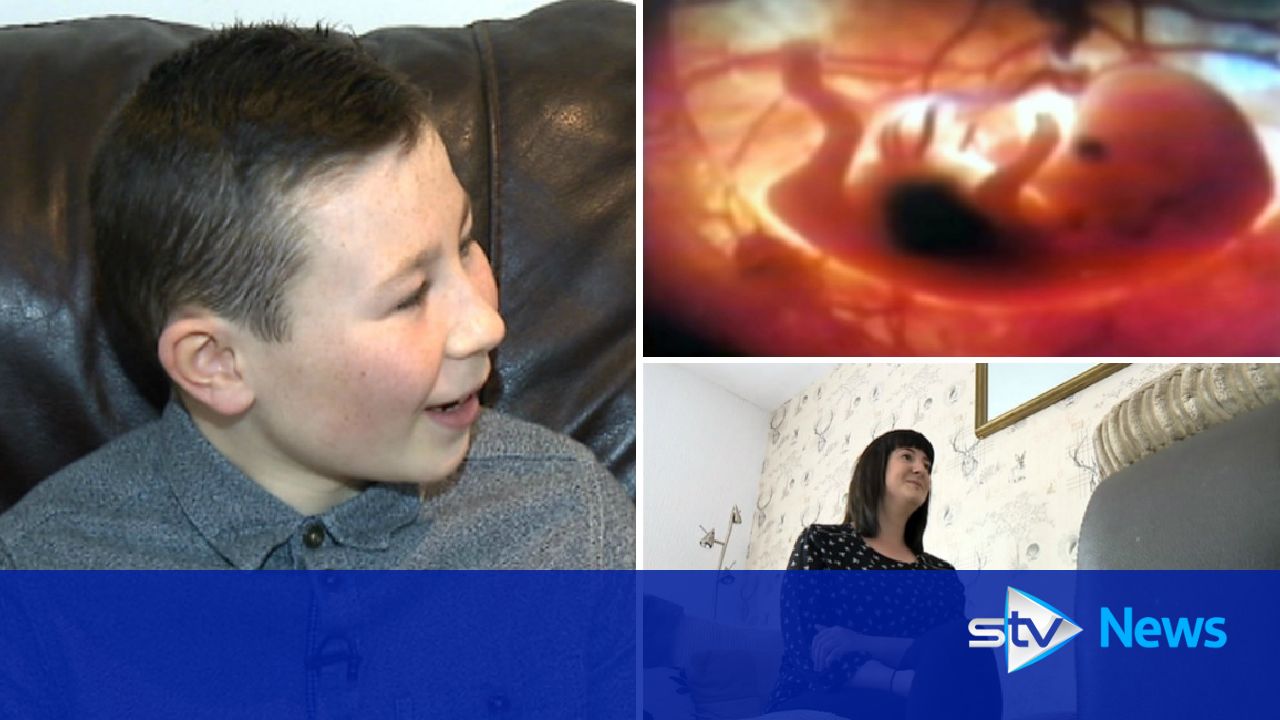 Born Different Living With Foetal Alcohol Spectrum Disorder