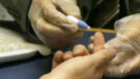Project: The first patient in the project was recruited from Stobhill Hospital.