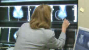 Cancer: New tests could help research of the disease.