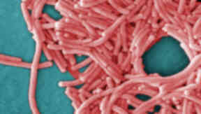 Legionella bacteria: Guests were exposed after using a hot tub.
