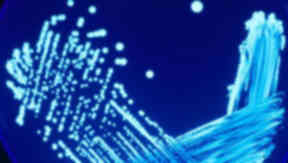 Legionnaire's Disease Legionella bacteria on microscope slide quality image