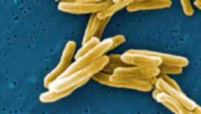 Tuberculosis: Breakthrough could save thousands of lives (file pic).