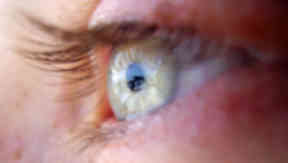 Eye