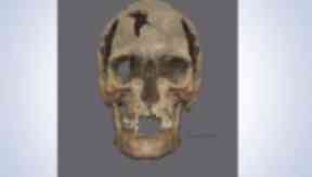 Skull: The man's face was reconstructed based on his skull.