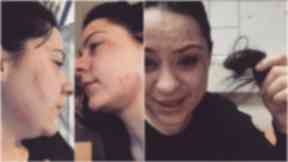 Lucy Spraggan shared these images after the alleged attack