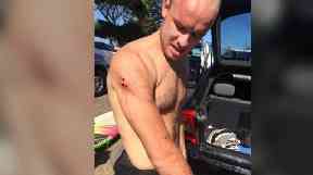 Charlie Fry began surfing after taking up work at a hospital in New South Wales.