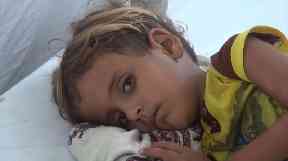 Young victims of the cholera outbreak are being treated for diahorrea and severe dehydration.