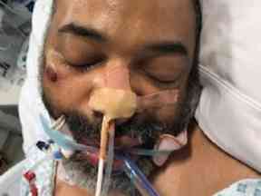 The injured man police are hoping to identify.
