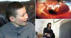Condition: People affected by FASD spoke out about it.