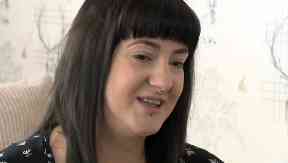 Leanne Craig: Diagnosed with condition as a baby.