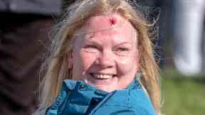 Struck: The spectator was pictured bleeding from a head wound.