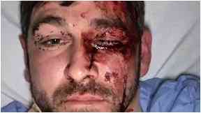 Left for dead: Euan Fraser was attacked in Australia.