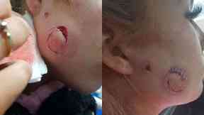 Kyra Strachan: She was allegedly attacked in Dundee.