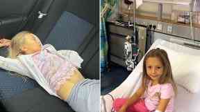 Ruby before her operation.