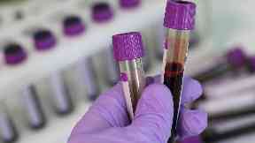 Blood: The inquiry is being held in Edinburgh.