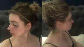 Injured: PC Alison Laughlan was attacked.