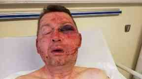 Attack: Paul McGregor was struck with an axe.