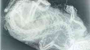 Investigation: Shotgun pellets were visible in many of the x-ray examinations.