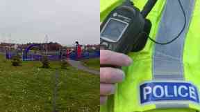 Glenrothes: The child suffered serious facial injuries.