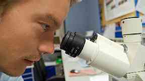 Scientists: Researchers in Edinburgh will chart the molecular architecture of the human brain.