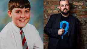 Colin Higgins is using his childhood ordeal to make people laugh.