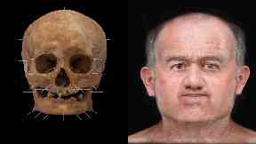 Skeleton 125: Facial reconstruction technology.