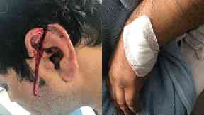 The pair slashed his ear and stabbed his head and back.