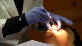 Dentist: Children took part in a three-year study.