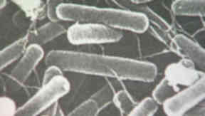 E. Coli: two children at Cumbernauld nursery have the bacteria